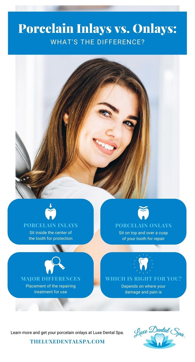 Porcelain Inlays vs. Onlays What’s The Difference? Luxe Dental